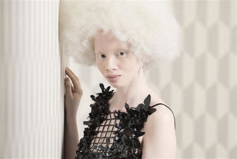South African Albino Model
