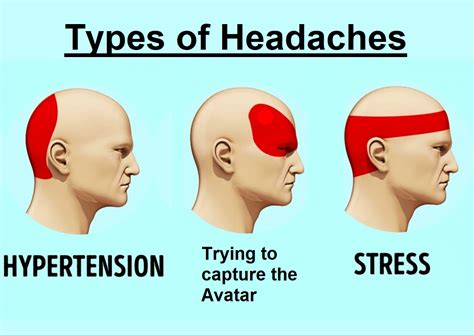 Types Of Headaches Rthelastairbender
