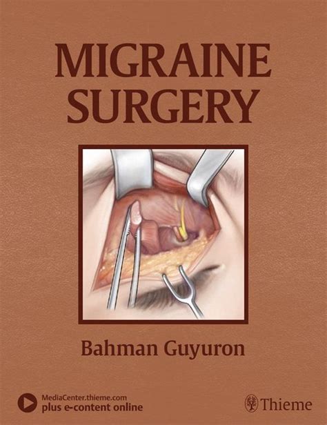 Migraine Surgery Ebook Bahman Guyuron 9781626237728 Boeken