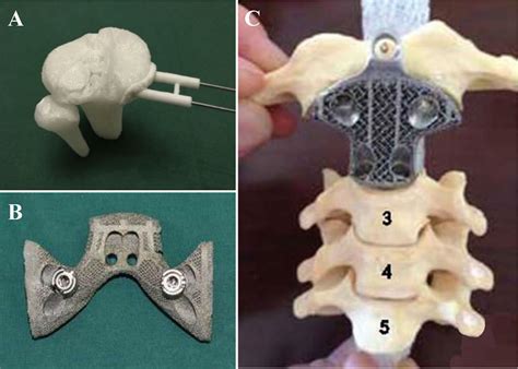 Frontiers Progressive 3d Printing Technology And Its Application In