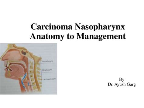 Nasopharynx Cancer Anatomy And Images