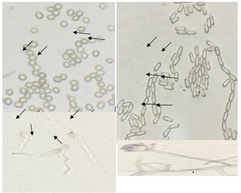 Conidia Of Beauveria Bassiana A And Metarhiziumanisopliae B Viable Download Scientific