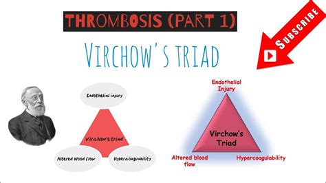 Thrombosis Pathology Lecture In Hindivirchows Triadvirchows Triad