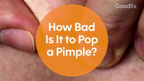 How Bad Is It To Pop A Pimple Really Goodrx