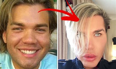Rodrigo Alves Before And After Pics Human Ken Doll Has Had Fifty Procedures Daily Express
