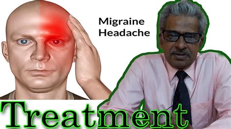 Migraine Headache Treatment In Homeopathy By Dr Ps Tiwari Youtube