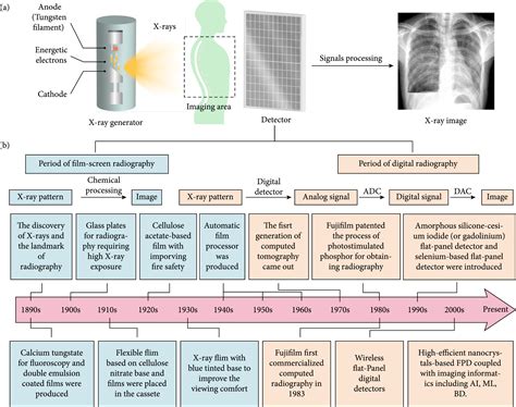 Recent Development In X Ray Imaging Technology Future And Challenges Research