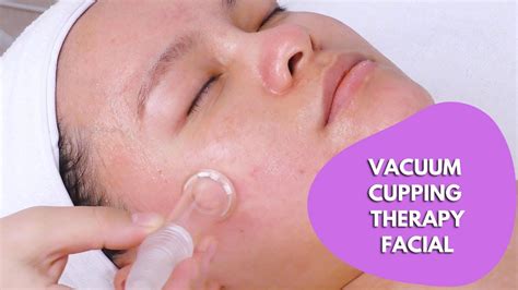 Vacuum Cupping Therapy Facial Facial Massage Lymphatic Drainage Massage Part 2 Mychway
