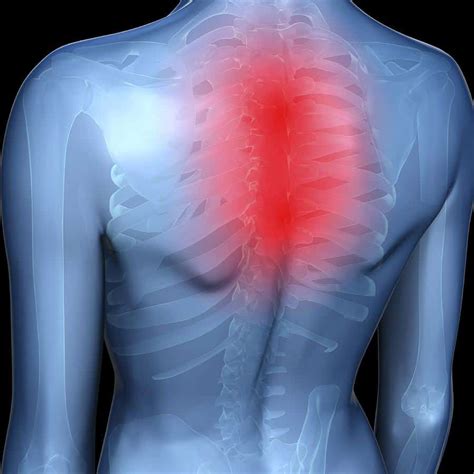 Most Common Causes Of Middle Back Pain