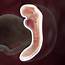 Fetal Development  5 Weeks Pregnant BabyCenter Canada