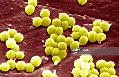 Staphylococcus Aureus Is A Widespread Bacteria Commonly Found On The
