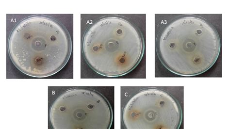 Batch 25 Endophytic Fungi Isolation And Studying Its Potential Against
