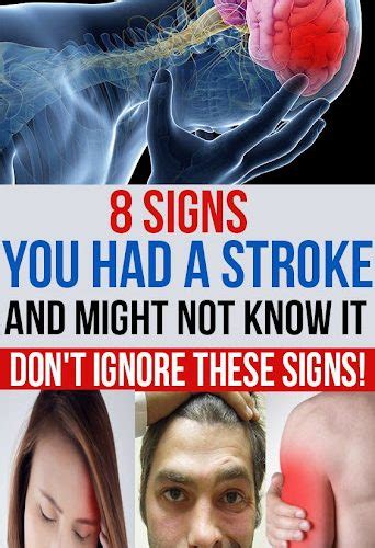 8 Signs You Had A Stroke And Might Not Know It Dont Ignore These