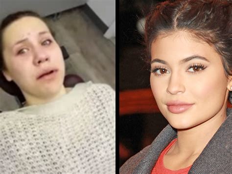 This Teen Woke Up After Surgery Thinking Shes Kylie