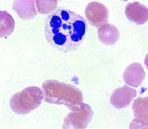 Anaplasma Blood Smear