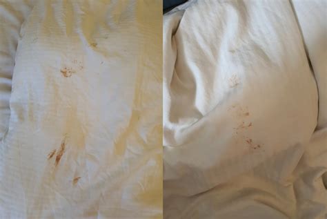 Woman Horrified To Find Blood And Other Fluid Stains On Bed Sheets In