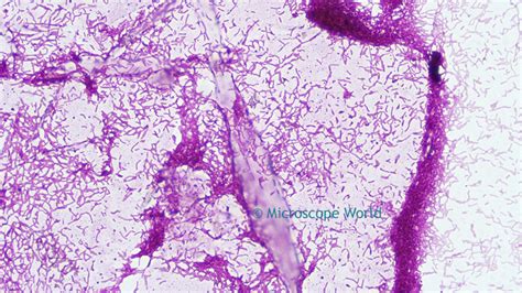 Microscope World Blog Rhodospirillum Rubrum Bacteria