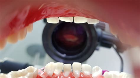 รักษาคลองรากฟันอย่างแม่นยำ ด้วยกล้องจุลศัลยกรรม Dental Operating