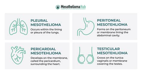 What Is Mesothelioma Symptoms Treatment And Life Expectancy