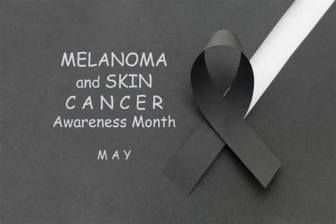 Melanoma Awareness Stock Photos Pictures And Royalty Free Images Istock