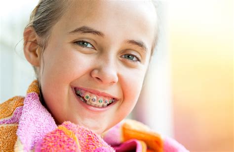 Tips On Choosing Braces Colours Browns Line Dental