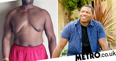 man who avoided dating because of his moobs has them surgically removed metro news