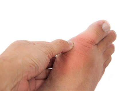 The Possible Causes Of Feet Discoloration Ph