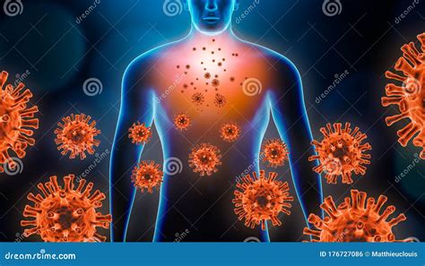 Viral Pneumonitis 3d Rendering Illustration With Red Virus Cells And