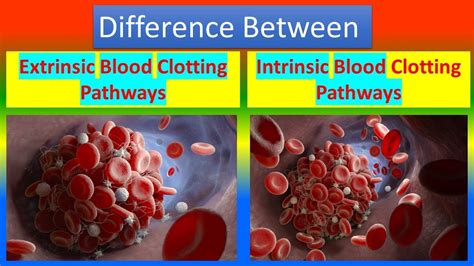 Difference Between Extrinsic Blood Clotting Pathways And Intrinsic Blood Clotting Pathways YouTube