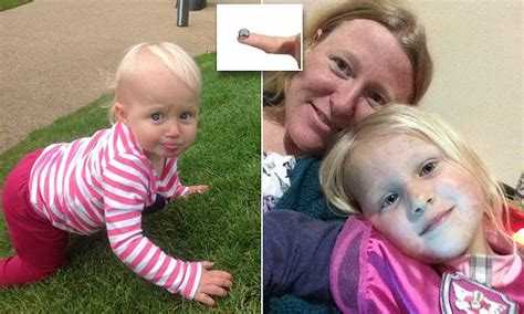 Mums Warning After Daughter 2 Swallowed Lithium Battery Daily Mail