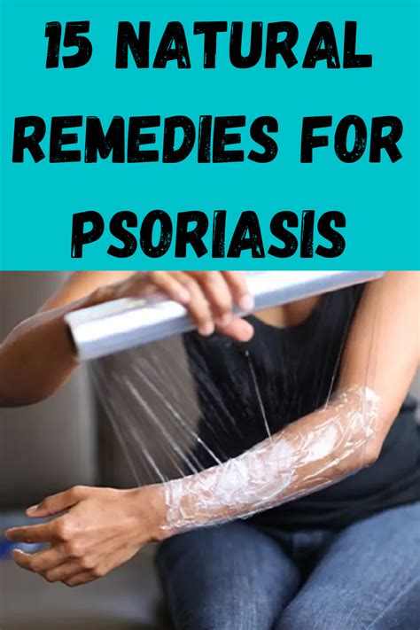 Have Psoriasis Everything You Need To Know To Naturally Heal Flaky