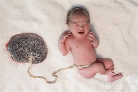 Amazing Facts About Placentas Colorado Birth Maternity Newborn