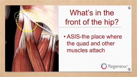Pain In The Front Of The Hip Causes And Treatments Available Youtube