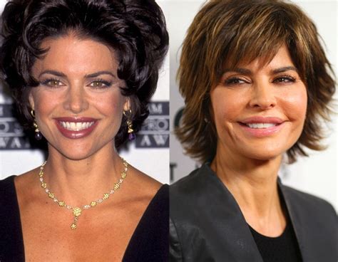 Lisa Rinna From Reality Tv Stars Most Dramatic Transformations E News