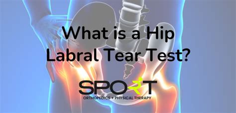 What Is A Hip Labral Tear Test Sport Orthopedic Dallas And Frisco