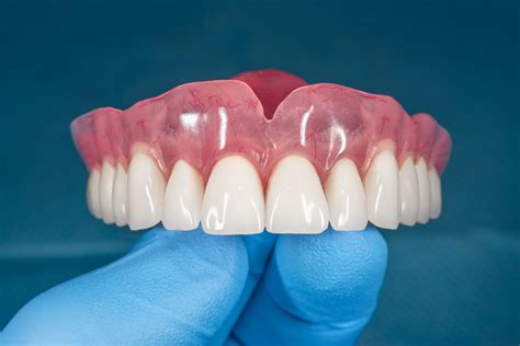 Dentures Southampton - Natural-looking ,Comfortable False Teeth