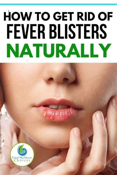 Home Remedies For Fever Blisters On The Lips To Help You Fight Cold