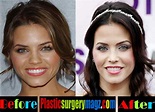 Jenna Dewan Plastic Surgery Before and After Photos | Plastic Surgery ...