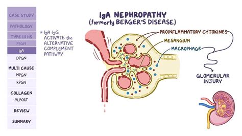 Types Of Nephritic Syndromes
