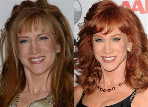 The daily show (sezon 1997, epizod 90). Kathy Griffin Plastic Surgery Before and After Botox ...
