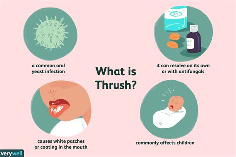 The Facts About Hiv And Thrush Candidiasis