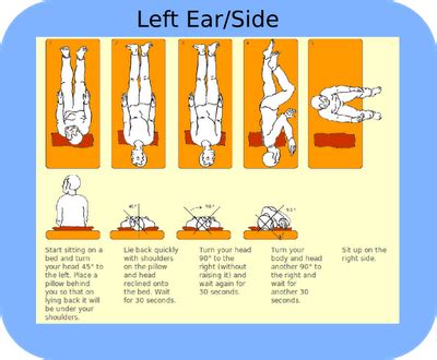 If a left sided canalithiasis is suspected, perform the steps but with the head. For BPV | Epley maneuver, Vertigo treatment, Vertigo