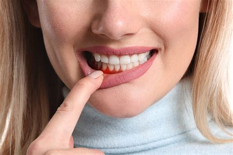 How Periodontal Disease Affects Your Overall Health Kitty Hawk Dental Care