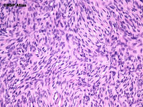 Hsp Atlas Histopathology Atlas