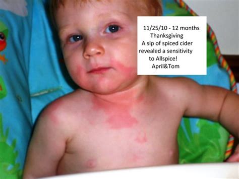 This allergic reaction is far more likely. food allergy (ranch dressing) - home testing ? - BabyCenter