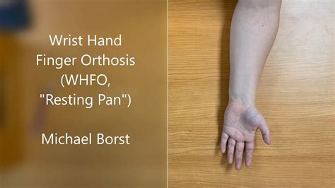 Volar Wrist Hand Finger Orthosis Whfo Fabrication Youtube