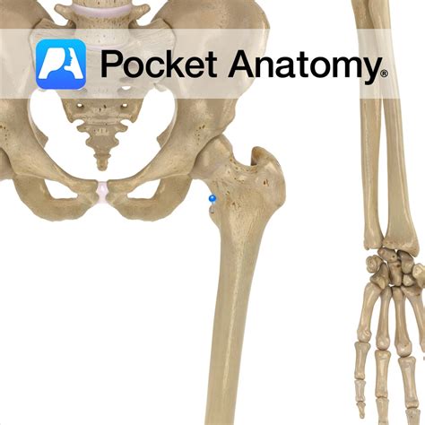 Femur Lesser Trochanter Pocket Anatomy