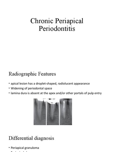 Chronic Periapical Periodontitis Pdf