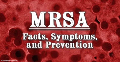 Mrsa Infection Symptoms And Prevention Free Report