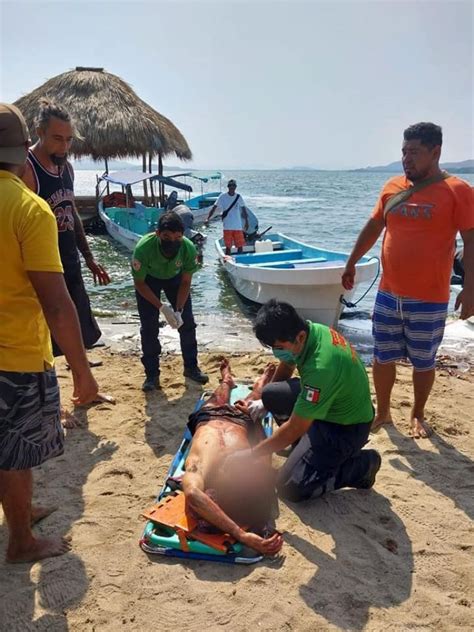 Turista Argentino Muere Tras Ataque Con Machete Recibió Cortes